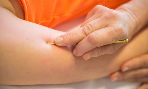 Wiederhergestellter Energiefluss durch Akupunkturmassage nach Willy Penzel